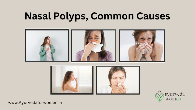 Nasal polyps Symptoms and causes